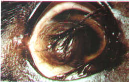 Redevet doenca cornea