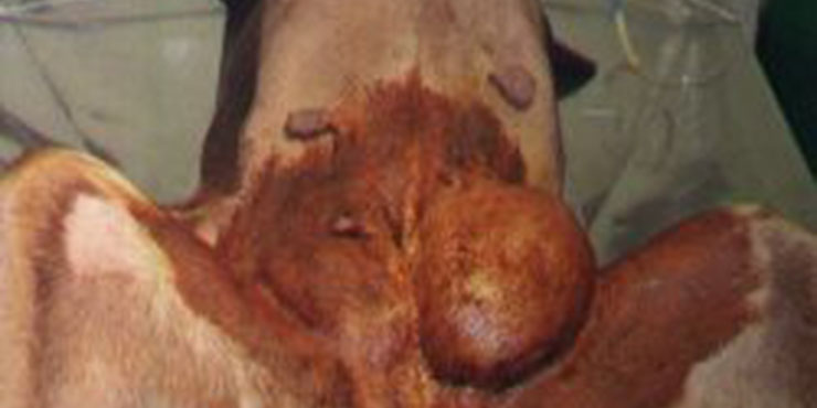 Redevet Hernia ingual1