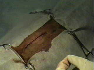 Redevet-Pneumotórax11