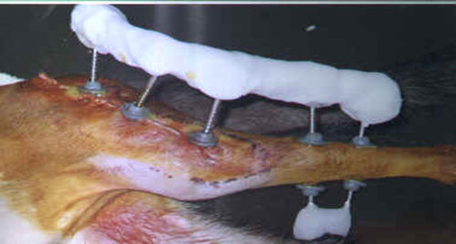 Redevet cirurgia fixação femur4