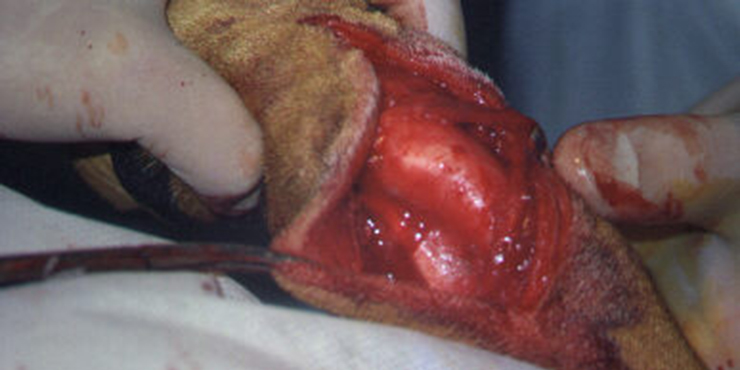 Redevet cirurgia radio ulna externo1