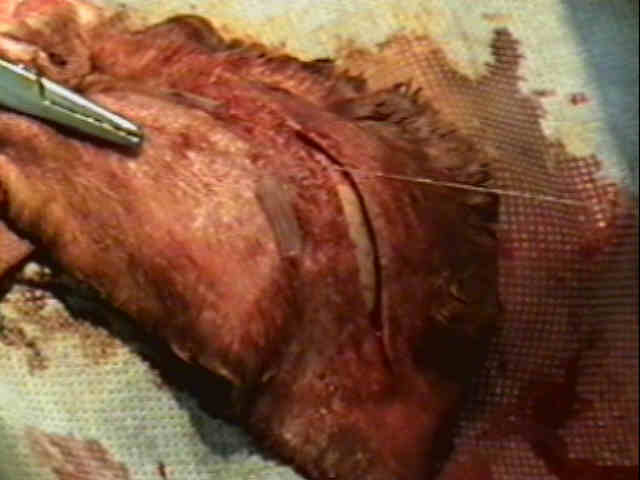 Redevet-otohematoma10