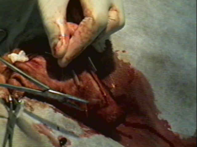 Redevet-otohematoma11