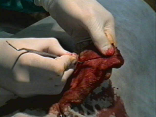 Redevet-otohematoma5