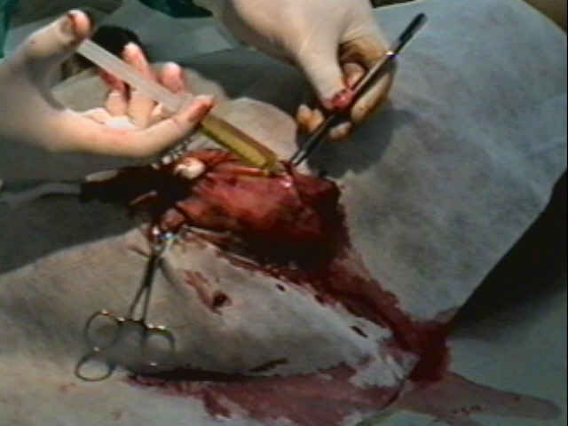 Redevet-otohematoma7