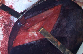 Redevet-pino-intromedular-femur5