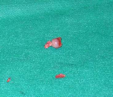 Redevet-resseccao-cabeca-femur-gatos6