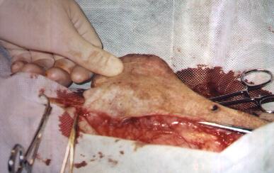 Redevet-tumor-mamario2