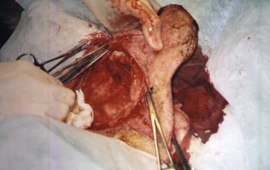 Redevet-tumor-mamario3