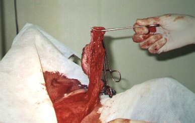 Redevet-tumor-mamario4