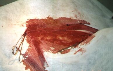 Redevet-tumor-mamario5